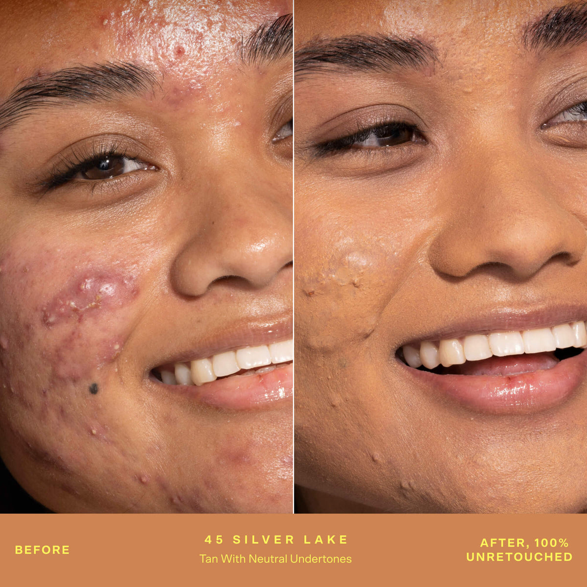 SunnyDays™ Tinted SPF 30 M8