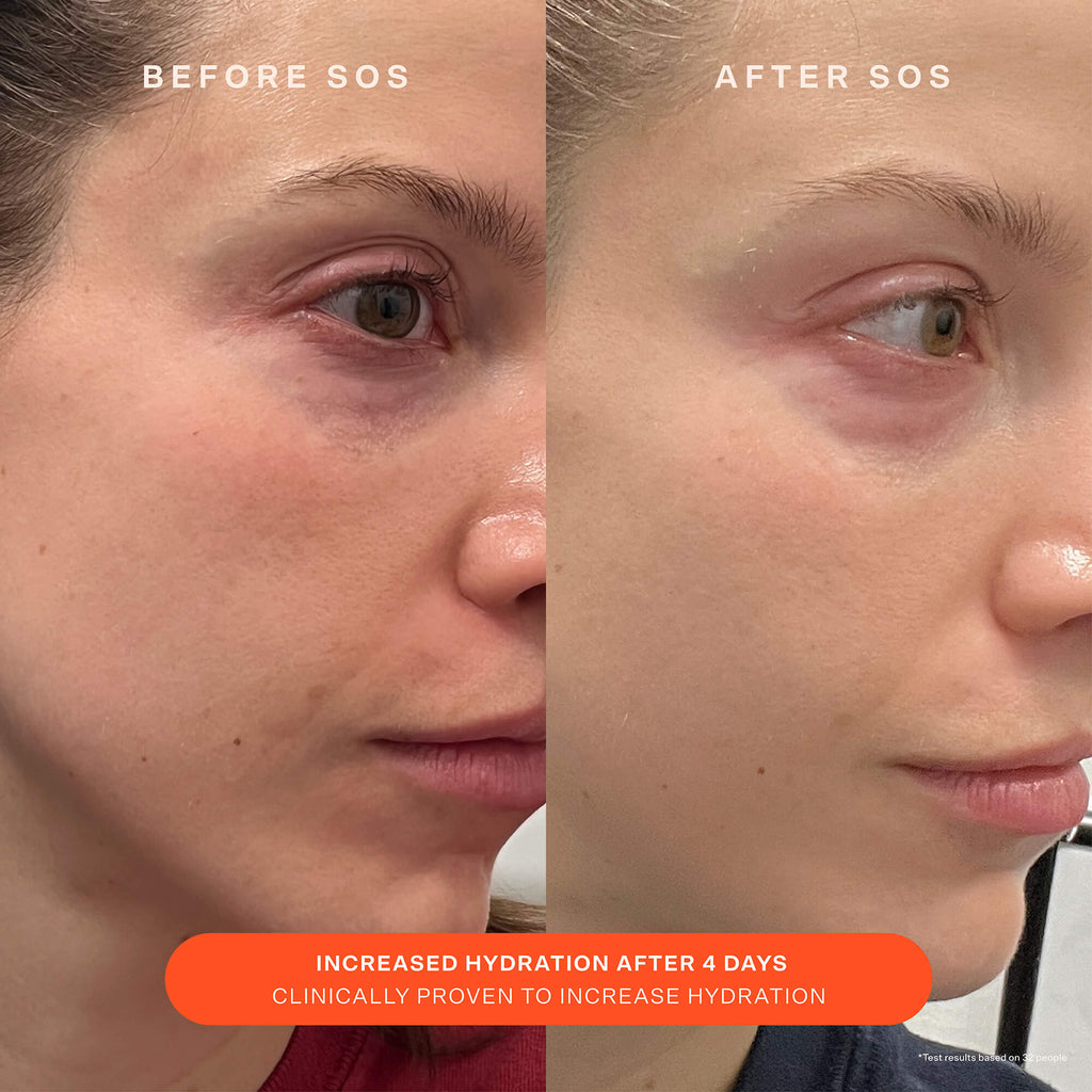 SOS Recovery Cream T9