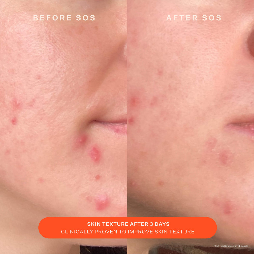 SOS Recovery Cream T9