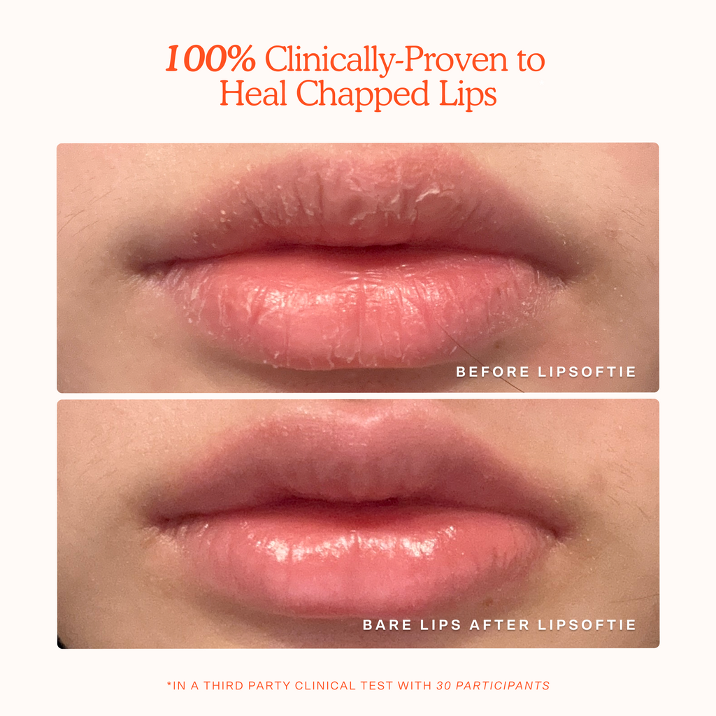 LipSoftie® Lip Treatment V9