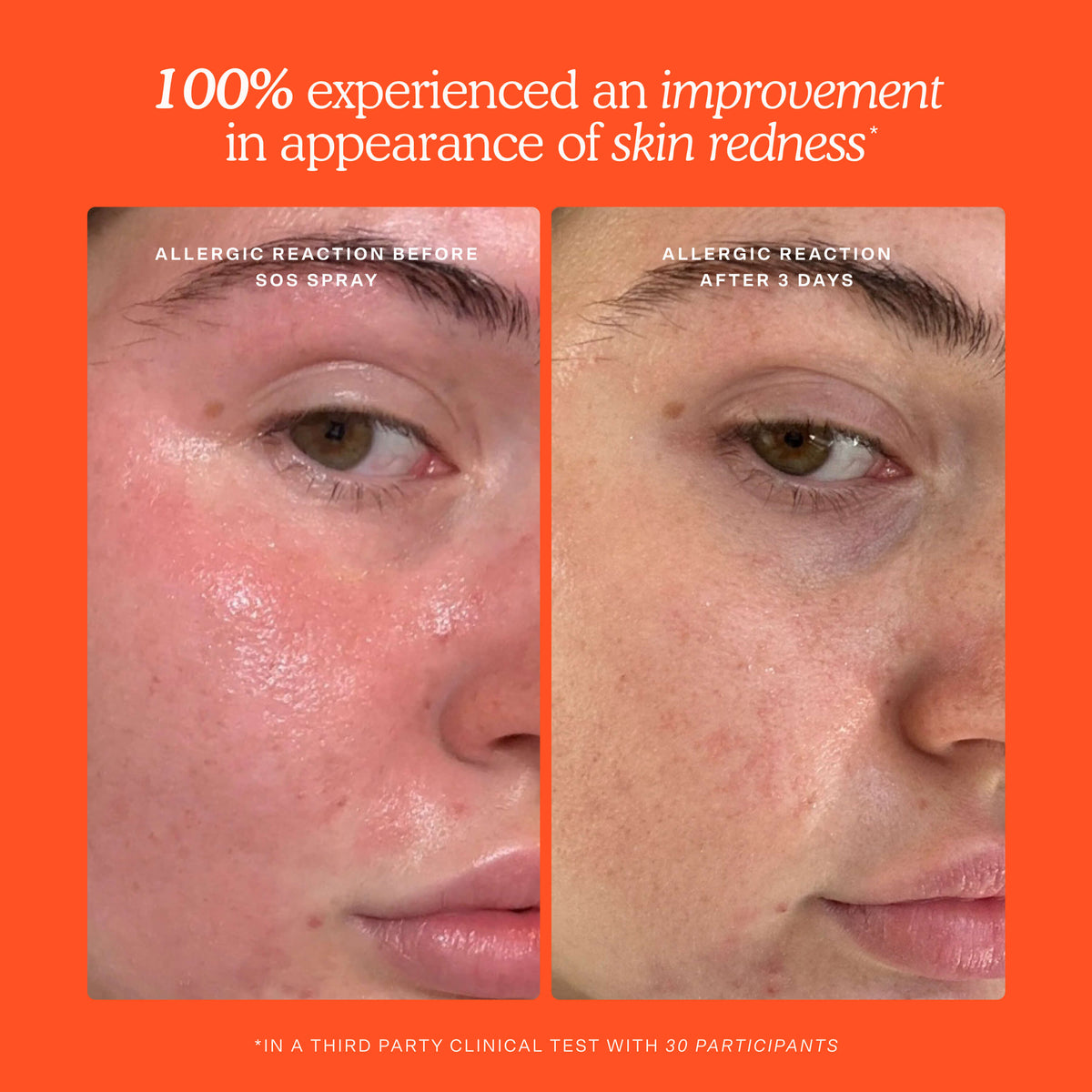 SOS Skincare Minis Kit X3