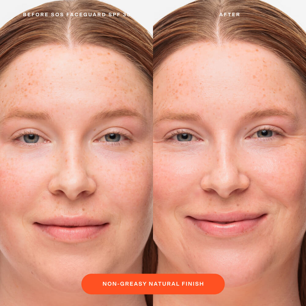 SOS FaceGuard™ SPF 30 Sunscreen PA+++ D8