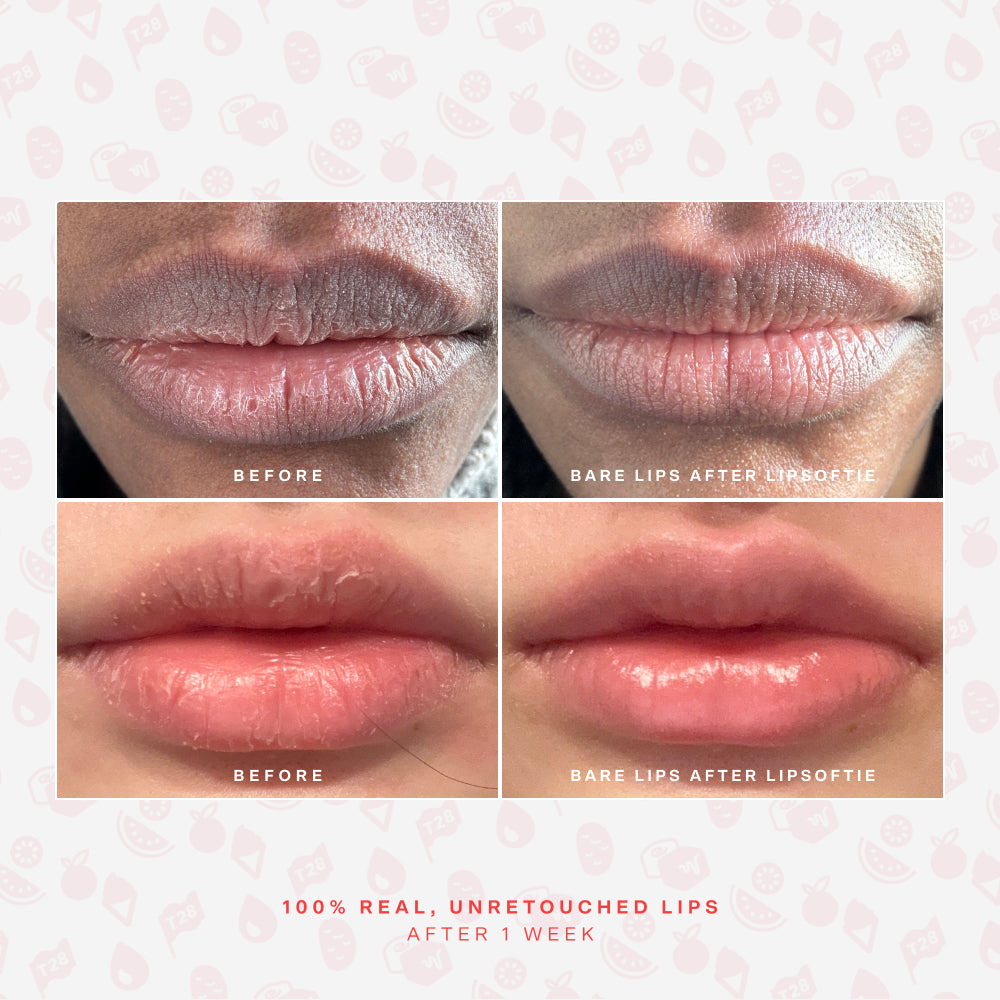 LipSoftie® Lip Treatment Set D9