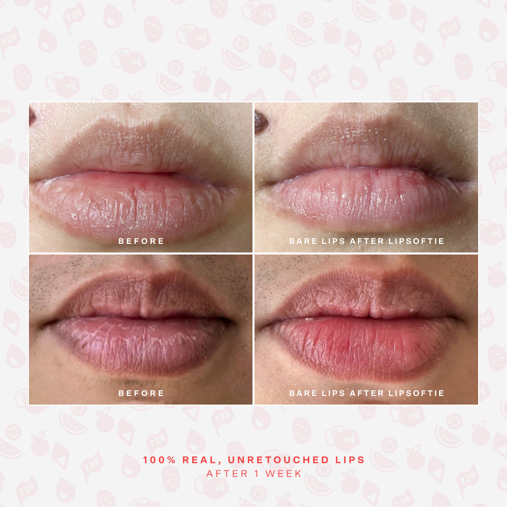 LipSoftie® Lip Treatment Set D9