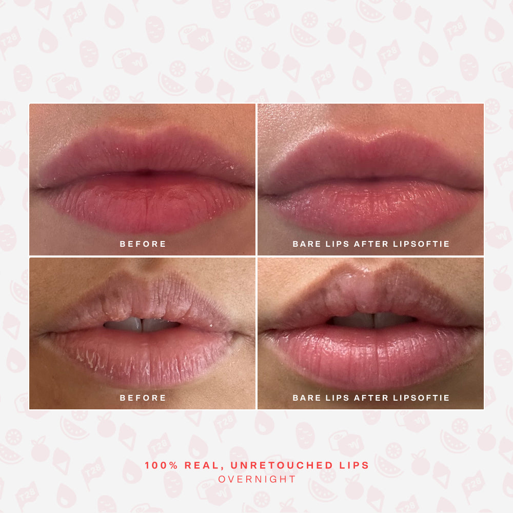 LipSoftie® Lip Treatment V9