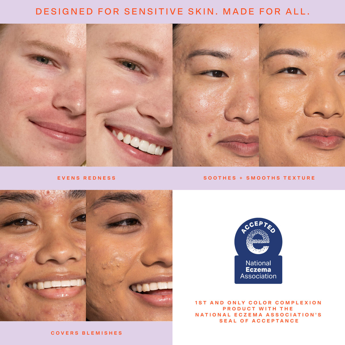 SunnyDays™ Tinted SPF 30 M8