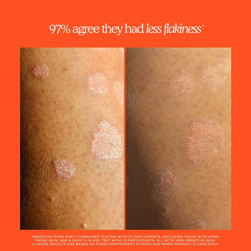 SOS Rescue + Relief Body Wash Treatment U5